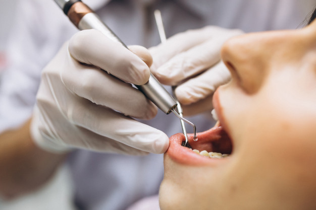 Vantagens em ter um plano odontológico